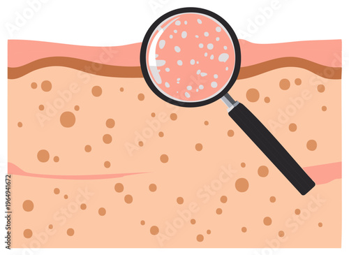 Magnifying glass examining a cross section of skin with pores and pigmentation