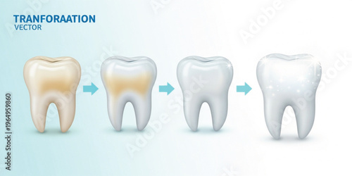 Teeth Whitening Process Illustration Showing Step by Step Dental Cleaning Transformation from Stained to Bright White Smile for Oral Care, Hygiene, and Treatment Concept