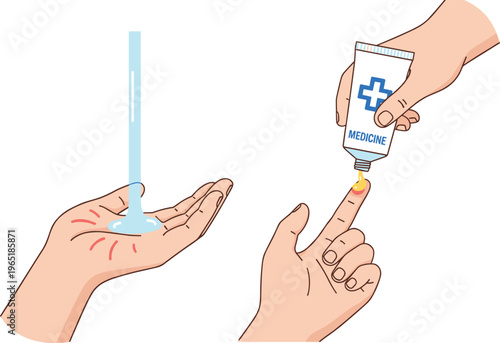 Cartoon first aid for minor burn in colorful vector illustration of cooling water and applying medicine ointment
