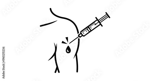 Close-up of a syringe injecting fluid into a person's arm, medical treatment concept