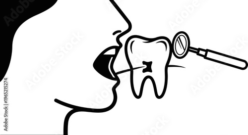 Close-up of open mouth with dentist mirror examining a tooth cavity