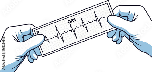 Two gloved hands hold a printed electrocardiogram, displaying heart activity