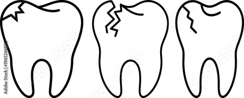 Illustrations of teeth with different types of cracks and damage