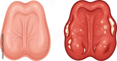 Two cartoonish tongues, one pale and lined, one bright red and spotted