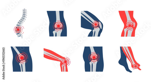 Human Body Joint Pain and Inflammation Icons Set