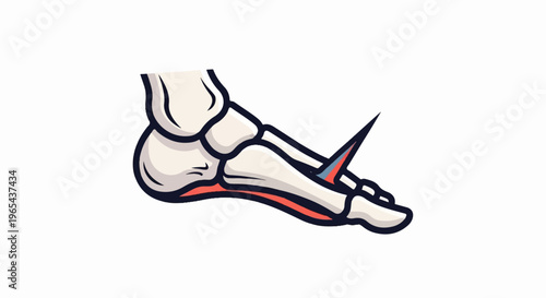 Stylized illustration of a human foot showing bones, muscles, and a sharp pointed object