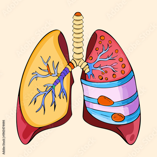 Lungs illustration showing a transition between healthy tissue and various patterns representing different stages of respiratory function or health conditions