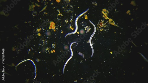 Nematodes with minimal movement among detritus panoramic view under 40x magnification darkfield microscopy. 4K scientific microscopy footage.