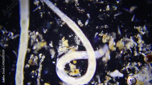 Annelids moving with rotifer colony in background under 40x magnification darkfield microscopy. 4K scientific microscopy footage.