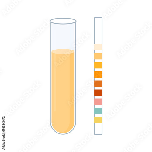 Urine sample tube and urinalysis reagent strip for kidney exam, urinary tract infection diagnostics. Ketone and PH rapid test strips for ketogenic and alkaline diets. Vector illustration.