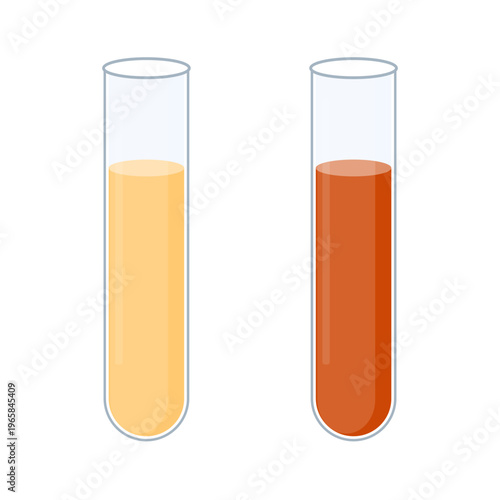Urine sample tube set with a lid for kidney exam, urinary tract infection and cystitis diagnostics. Ketone and PH rapid test for ketogenic and alkaline diets. Medical vector illustration.