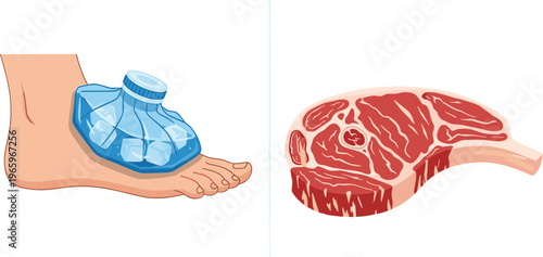 First aid ice pack on injured ankle with ice cubes and blue water bag alongside fresh raw beef steak with marble texture vector illustration.