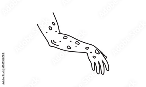 Human arm with a visible rash and spots, indicating a skin condition.