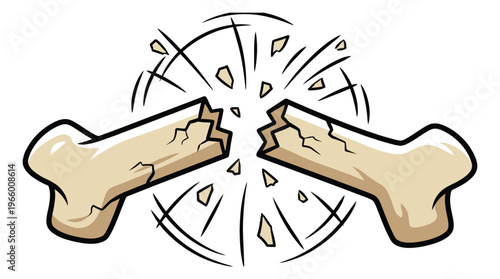Cartoon illustration of a broken bone depicting a snapping fracture with impact lines for medical and sports injury design
