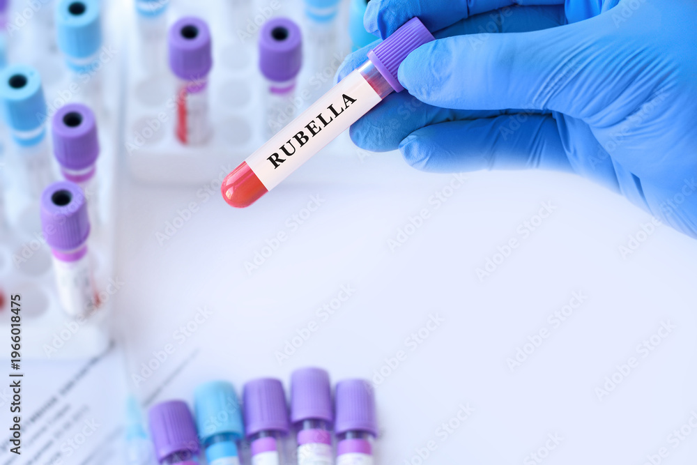 Naklejka premium Doctor holding blood sample tube with rubella test in clinical laboratory, serological blood analysis for viral infection immunity screening, prenatal diagnostics and preventive healthcare concept