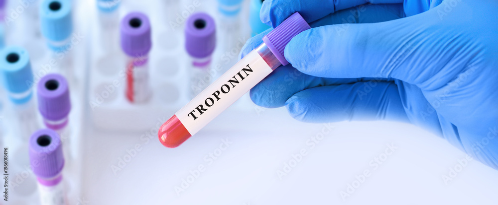 Naklejka premium Doctor holding blood sample tube with troponin test in medical laboratory, cardiac diagnostics and acute heart condition concept