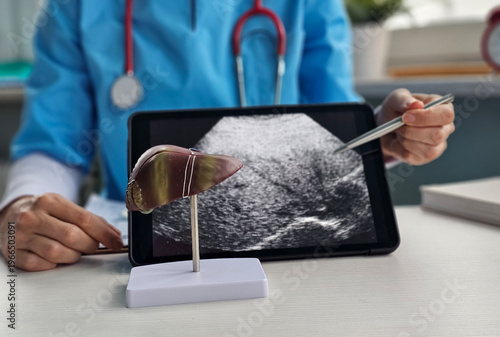 Medical professional shows liver model while explaining ultrasound results to patient using tablet