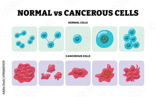 Normal vs Cancerous cells difference. Growth development abnormal cell and divide, variation shapes, abnormal number of chromosomes, cluster cells without boundary. Tumor cell process.