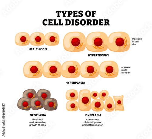 Different types of cell disorder types set collection. Labeled healthy, hypertrophy, hyperplasia, neoplasia, dysplasia. Increase cell size, increase number. Abnormal of development growth cells.
