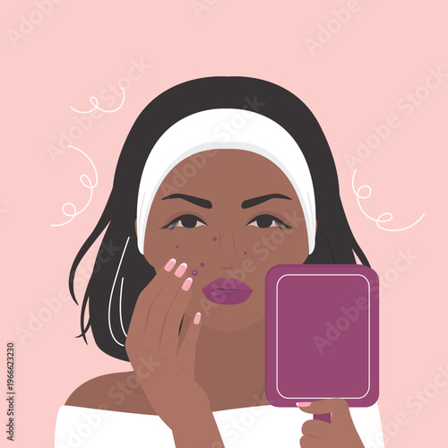 woman popping pimple on her cheek, experiencing skin problems, dermatological issues, hormonal imbalance. Beauty girl woman looking in the mirror and picking acne