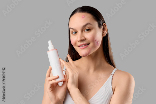 Young woman with acne probl...