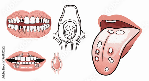 Medical illustrations of mouth conditions dental decay, lesions, and anatomy