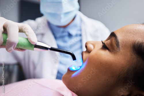Hands, dentist or dental curing light for procedure, tooth filling or healthcare ppe in clinic. LED, woman or patient with medical orthodontist, oral wellness or tools for mouth hygiene with implant