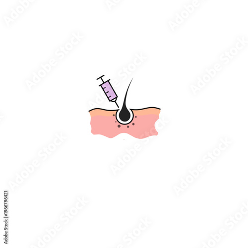 hair follicle injection procedure, conceptualizing PRP therapy, scalp mesotherapy, and clinical treatments for hair loss and restoration in a clean vector style.