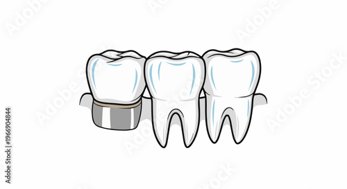 Three cartoon teeth, one with a metal crown, displayed against white background