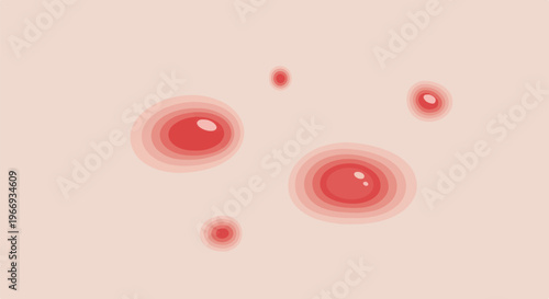 Close-up of skin with several red, inflamed blemishes