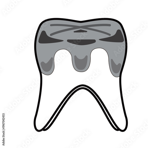 Cute cartoon molar tooth with silver crown and cavity, dental illustration