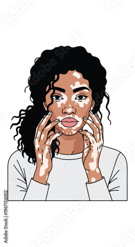 A stylized illustration of a woman with curly hair and skin pigment patches