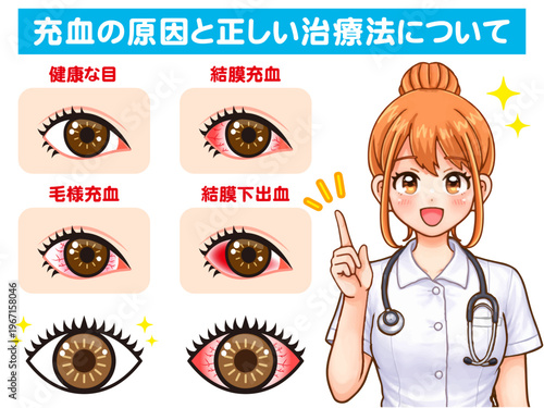 ドライアイの説明をする看護師の女性のアニメ系イラスト素材2