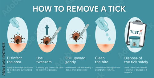 How to remove tick steps Infographic banner. Instruction to prevent Lyme or borreliosis disease because of mite bite. Laboratory testing.