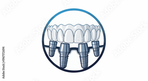 Dental implants supporting a full set of white, even teeth within a circular frame