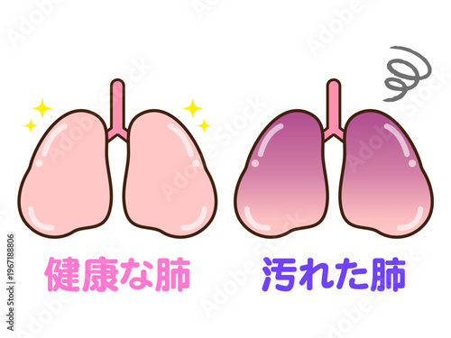 	健康な肺と汚れた肺のイラスト素材2