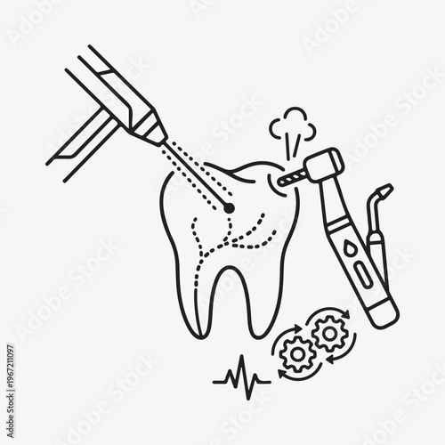 Dental drill removing decay from a tooth illustrating a dental procedure