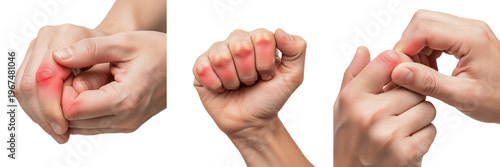 Man suffering from finger joint pain and inflammation, Rheumatoid Arthritis symptoms or hand injury isolated on white background