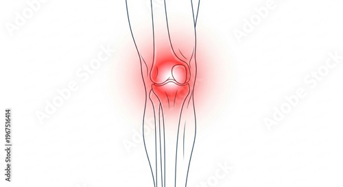A medical illustration of a knee with pain depicted in red