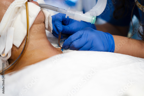 Nurse adjusting tracheostomy tube on intubated patient