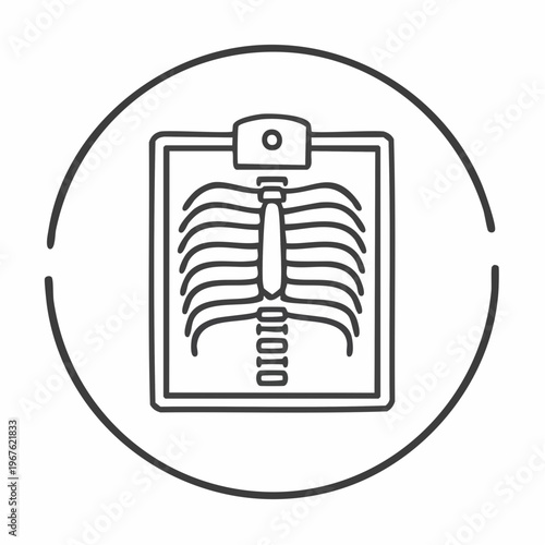 Medical illustration of an x ray of a human rib cage and spine.