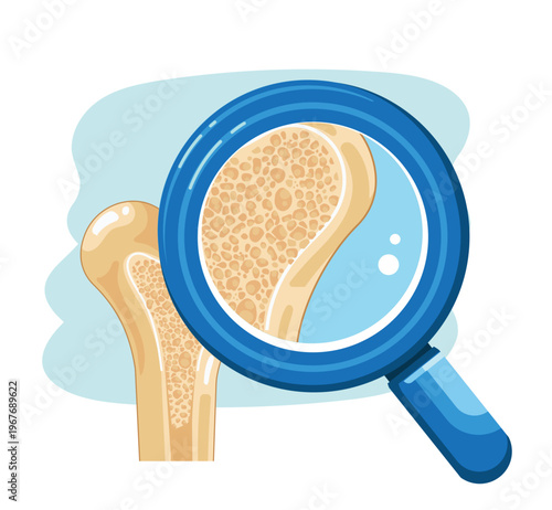 Healthy Bone Density Cross Section with Magnifying Glass Illustration