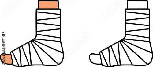Leg Foot in Plaster Cast Bandage Medical Illustration