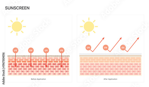 UV Protection Sunscreen Before and After Comparison on Skin Structure with Sun Rays