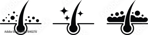 Hair follicle condition icons showing clogged pores, clean scalp with sparkles, and severe buildup, representing dermatology, hygiene, and hair care product concepts