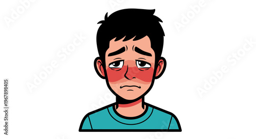 Vector illustration of a young man with a red butterfly rash on his face and a sad expression, depicting symptoms of systemic lupus erythematosus (SLE) or skin inflammation.