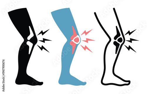 Three Stylized of Knee Pain and Joint Discomfort