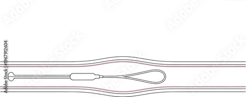 Medical of a Catheter with a Loop and Balloon in a Vessel