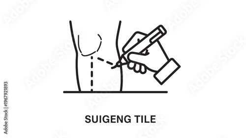 A medical illustration showing a hand marking a vein on an arm with a marker for cannulation or intravenous access, often used in healthcare settings for procedures.