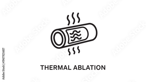 A medical illustration depicting thermal ablation, a minimally invasive treatment using heat to destroy abnormal tissue.
